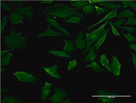 Monoclonal Anti-DFNB31 antibody produced in mouse clone 2D12, purified immunoglobulin, buffered aqueous solution