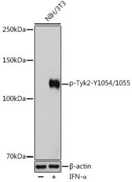 Anti-Phospho-Tyk2-Y1054/1055