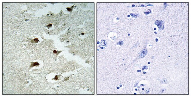 Anti-CDCA4 antibody produced in rabbit affinity isolated antibody