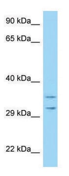 Anti-RPS2 antibody produced in rabbit affinity isolated antibody