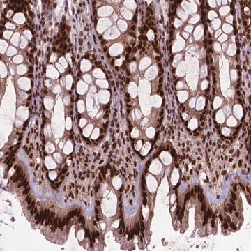 Anti-SIRT6 antibody produced in rabbit Prestige Antibodies&#174; Powered by Atlas Antibodies, affinity isolated antibody, buffered aqueous glycerol solution