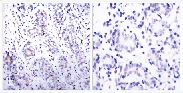 Anti-STAT3 (Ab-727) antibody produced in rabbit affinity isolated antibody