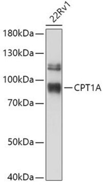 Anti-CPT1A antibody produced in rabbit