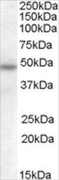 Anti-SERPINA12 antibody produced in goat affinity isolated antibody, buffered aqueous solution