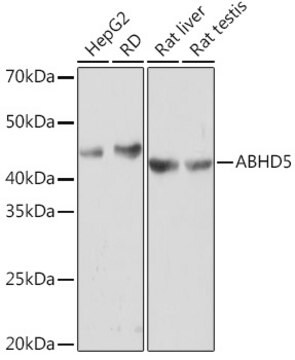 Anti-ABHD5 Antibody, clone 2K8W9, Rabbit Monoclonal