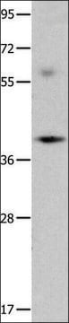 Anti-OPCML antibody produced in rabbit affinity isolated antibody