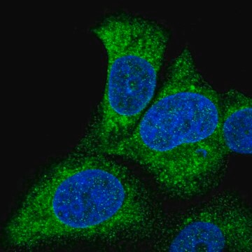 Anti-SLC27A3 antibody produced in rabbit Prestige Antibodies&#174; Powered by Atlas Antibodies, affinity isolated antibody