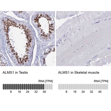 Anti-ALMS1 antibody produced in rabbit Prestige Antibodies&#174; Powered by Atlas Antibodies, affinity isolated antibody, buffered aqueous glycerol solution