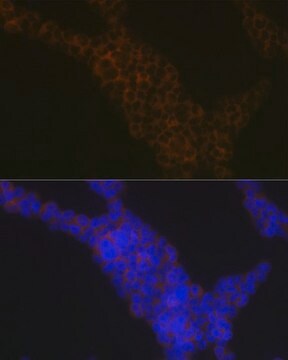 Anti-LSP1 antibody produced in rabbit