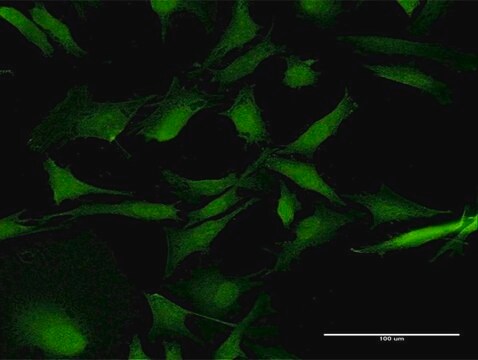 Anti-RAB31 antibody produced in mouse purified immunoglobulin, buffered aqueous solution