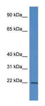 Anti-RPL12 (N-terminal) antibody produced in rabbit affinity isolated antibody