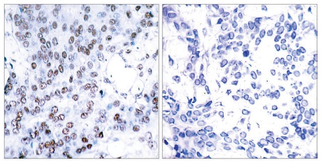 Anti-JUNB antibody produced in rabbit affinity isolated antibody