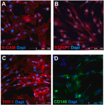 Human Mesenchymal Stem Cells (derived from hES cells) Includes 1 million viable cells of Human Mesenchymal Stem Cells (derived from hES cells).