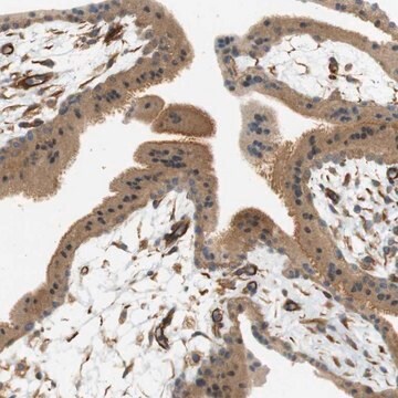 Anti-CYTH3 antibody produced in rabbit Prestige Antibodies&#174; Powered by Atlas Antibodies, affinity isolated antibody, buffered aqueous glycerol solution