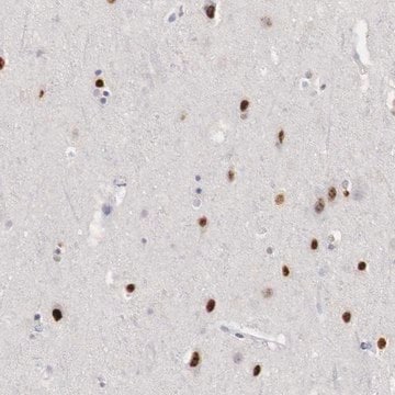 Anti-FOXP2 antibody produced in rabbit AB1, Prestige Antibodies&#174; Powered by Atlas Antibodies, affinity isolated antibody, buffered aqueous glycerol solution