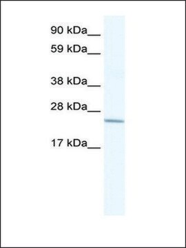 Anti-CRIP2 antibody produced in rabbit affinity isolated antibody