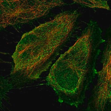 Anti-Cd83 Antibody Produced In Rabbit Prestige Antibodies&#174; Powered by Atlas Antibodies, affinity isolated antibody, buffered aqueous glycerol solution