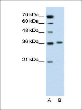 Anti-PIPOX antibody produced in rabbit affinity isolated antibody