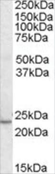 Anti-KLF16/DRRF antibody produced in goat affinity isolated antibody, buffered aqueous solution