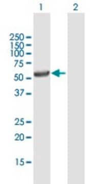 Anti-UGT3A1 antibody produced in mouse purified immunoglobulin, buffered aqueous solution