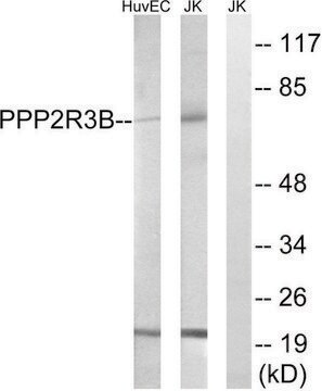 Anti-PPP2R5D antibody produced in rabbit affinity isolated antibody