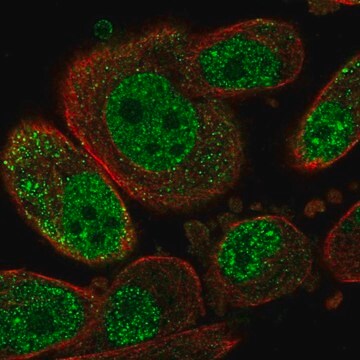 Anti-SETD6 antibody produced in rabbit Prestige Antibodies&#174; Powered by Atlas Antibodies, affinity isolated antibody