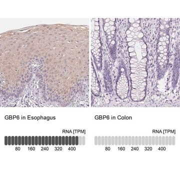 Anti-GBP6 antibody produced in rabbit Prestige Antibodies&#174; Powered by Atlas Antibodies, affinity isolated antibody, buffered aqueous glycerol solution