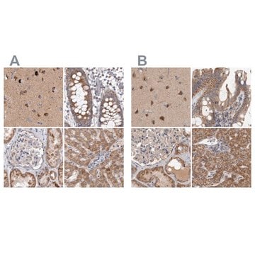 Anti-SCO1 antibody produced in rabbit Prestige Antibodies&#174; Powered by Atlas Antibodies, affinity isolated antibody, buffered aqueous glycerol solution, Ab1