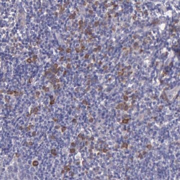 Anti-ZC3H12B antibody produced in rabbit Prestige Antibodies&#174; Powered by Atlas Antibodies, affinity isolated antibody, buffered aqueous glycerol solution