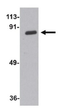 抗-ZC3H12A抗体 from rabbit, purified by affinity chromatography