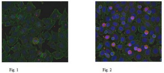 Anti-SR-25 Antibody, clone 1F6.1 clone 1F6.1, from mouse