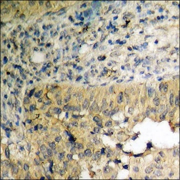 Anti-phospho-IRF-3 (pSer385) antibody produced in rabbit affinity isolated antibody