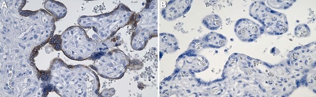 Anti-Aromatase Antibody, clone 1D23 ZooMAb&#174; Rabbit Monoclonal recombinant, expressed in HEK 293 cells