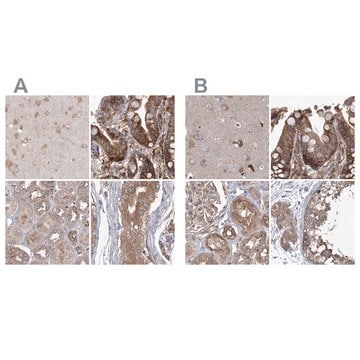 Anti-EIF3A antibody produced in rabbit Prestige Antibodies&#174; Powered by Atlas Antibodies, affinity isolated antibody, buffered aqueous glycerol solution