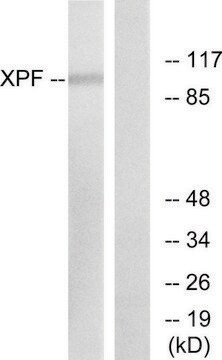 Anti-XPF antibody produced in rabbit affinity isolated antibody