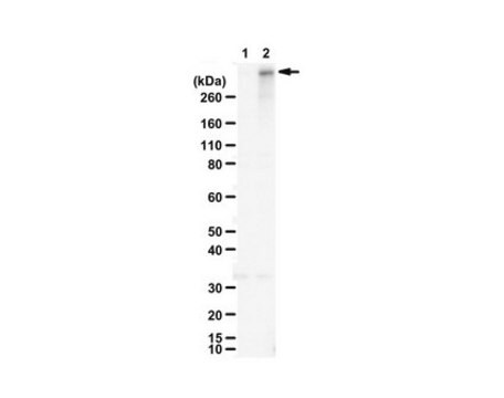 Anti-Ringfingerprotein 213 (RNF213) from rabbit