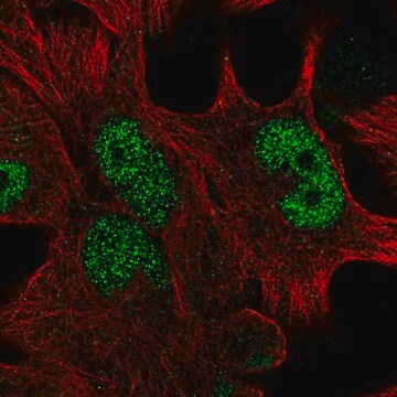 Anti-HOXD13 antibody produced in rabbit Prestige Antibodies&#174; Powered by Atlas Antibodies, affinity isolated antibody