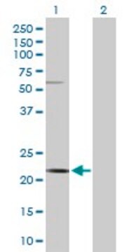 Anti-CSN3 antibody produced in rabbit purified immunoglobulin, buffered aqueous solution