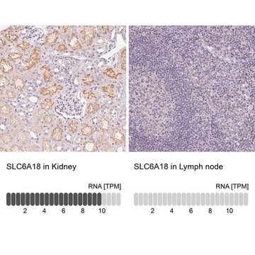 Anti-SLC6A18 antibody produced in rabbit Prestige Antibodies&#174; Powered by Atlas Antibodies, affinity isolated antibody, buffered aqueous glycerol solution