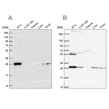 Anti-PMM2 antibody produced in rabbit Prestige Antibodies&#174; Powered by Atlas Antibodies, affinity isolated antibody, buffered aqueous glycerol solution