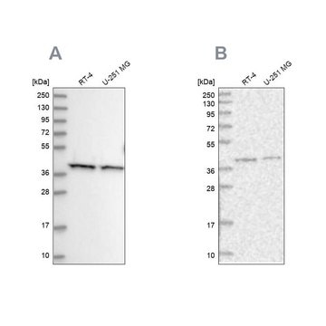 Anti-PSMD13 antibody produced in rabbit Prestige Antibodies&#174; Powered by Atlas Antibodies, affinity isolated antibody, buffered aqueous glycerol solution