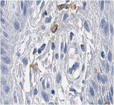 Anticorps anti-TRP1/TYRP1, clone&nbsp;TA99, sans azoture clone TA99, 1&#160;mg/mL, from mouse