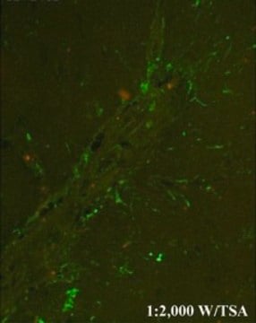 Anti-CHI3L1 affinity isolated antibody