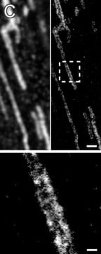 抗ACO2 ウサギ宿主抗体 Prestige Antibodies&#174; Powered by Atlas Antibodies, affinity isolated antibody, buffered aqueous glycerol solution