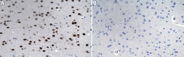 Anticuerpo anti-Tbr1 from rabbit, purified by affinity chromatography