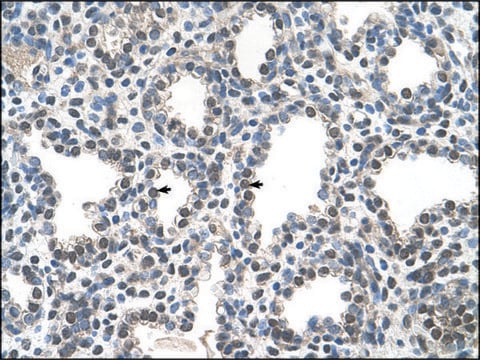 Anti-PPIB (AB1) antibody produced in rabbit IgG fraction of antiserum