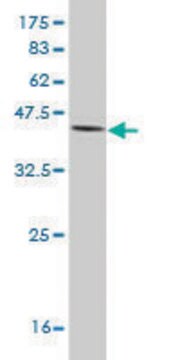 Monoclonal Anti-IL18BP antibody produced in mouse clone 2A9, purified immunoglobulin, buffered aqueous solution