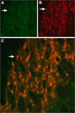 Anti-Potassium Channel KV11.2 (erg2) antibody produced in rabbit affinity isolated antibody, lyophilized powder