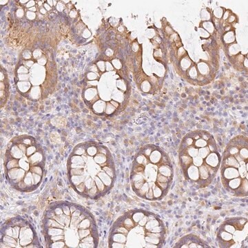 Anti-DENND5A antibody produced in rabbit Prestige Antibodies&#174; Powered by Atlas Antibodies, affinity isolated antibody, buffered aqueous glycerol solution