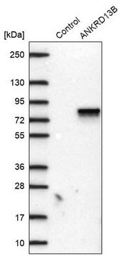 Anti-ANKRD13B antibody produced in rabbit Prestige Antibodies&#174; Powered by Atlas Antibodies, affinity isolated antibody, buffered aqueous glycerol solution